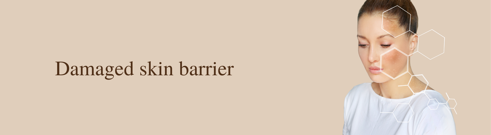 Damaged Skin Barrier