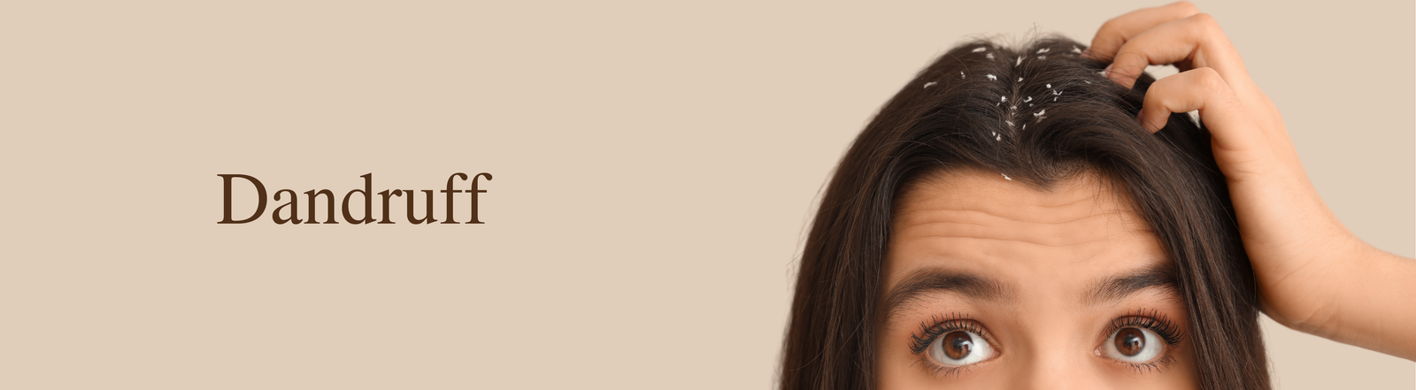 Dandruff
